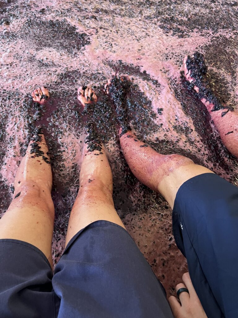 Stained legs from the juices of grapes after stomping on them in lagres.